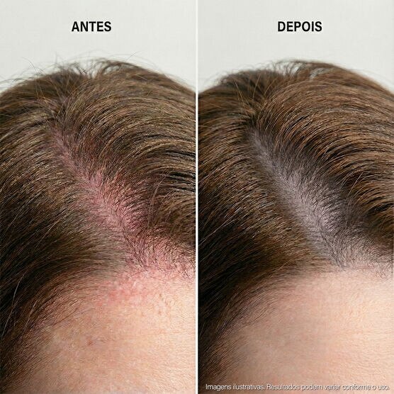 Condicionador para Couro Cabeludo Sens&iacute;vel Keune Care Scalp Sensitive